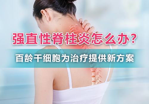 严重强直性强直性脊柱炎治疗费用